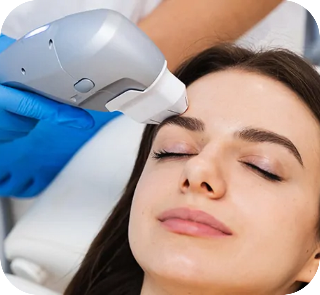 Laser Treatments