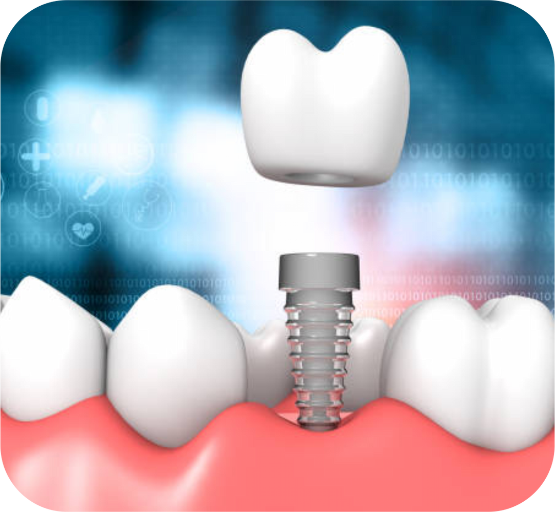 Implantology