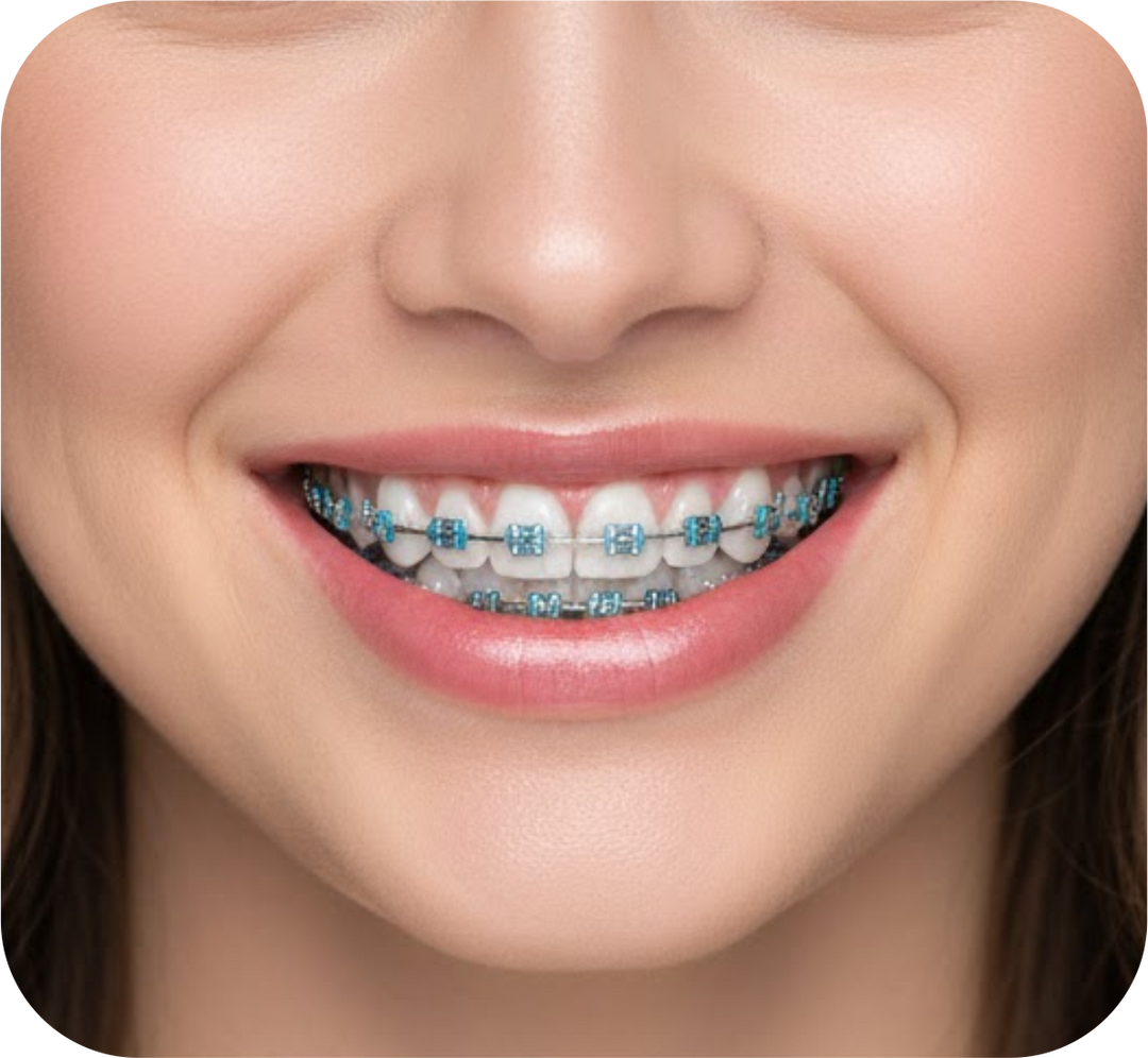 Orthodontics