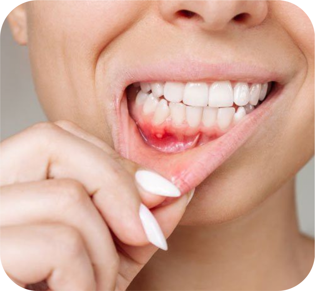 Periodontics