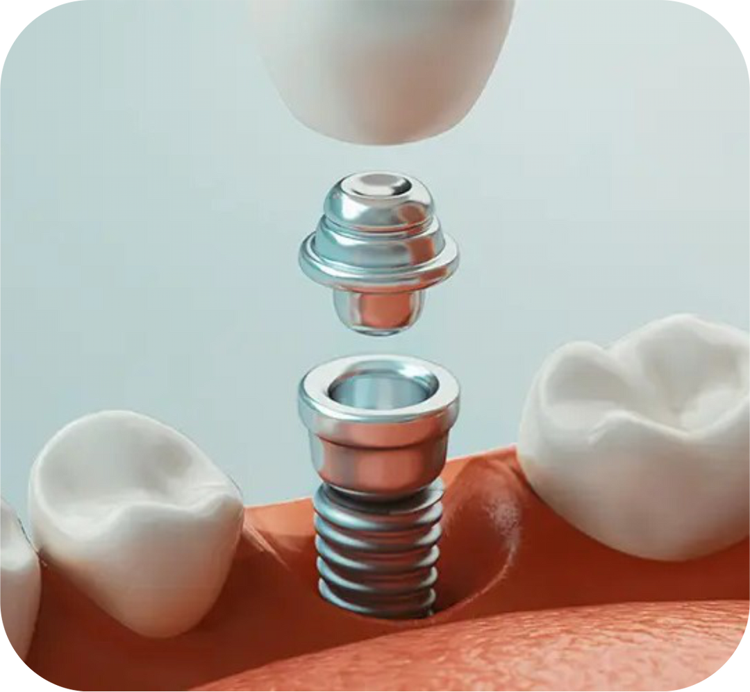 Prosthodontics